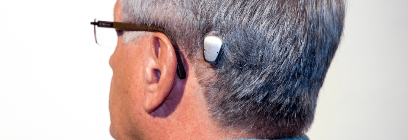 Bone Anchored Hearing Aid