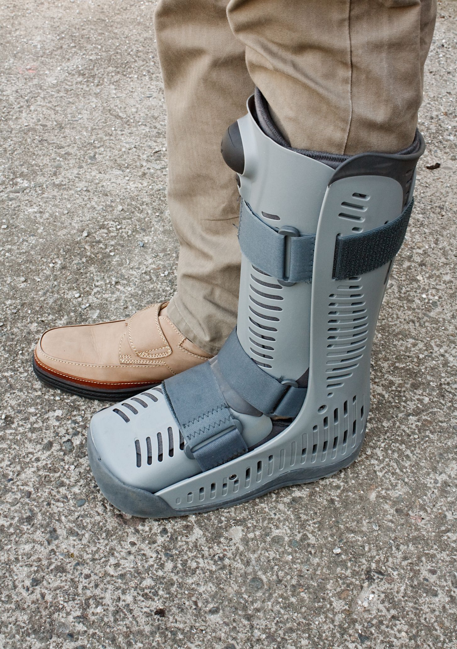 A man wears a large ankle boot while recovering from ankle replacement surgery.