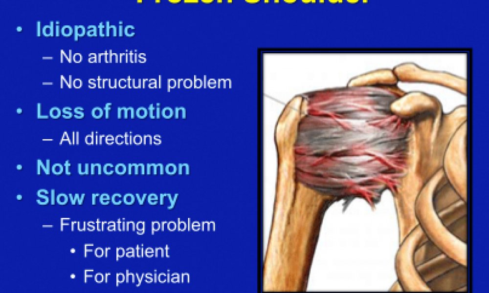 effect of shoulder presentation