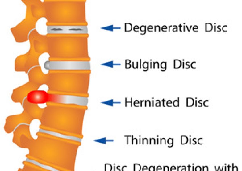 common-causes-of-back-pain-proliance-orthopedic